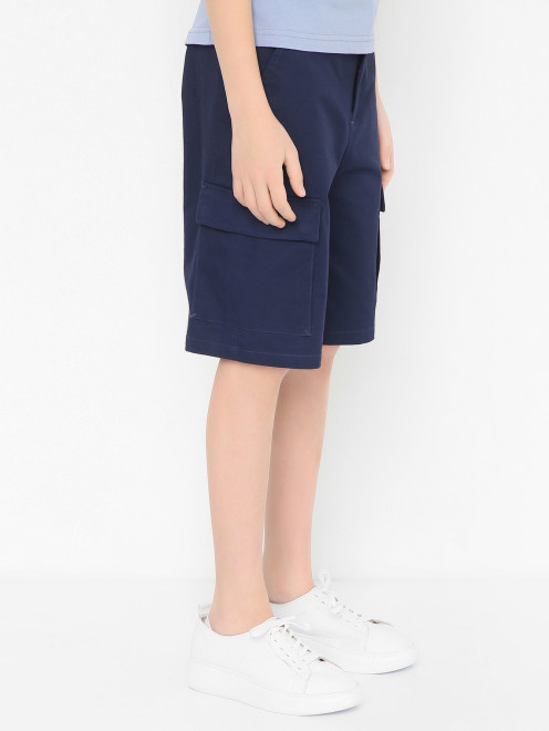 Хлопковые шорты с вышивкой Moschino - МодельВерхНиз